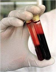 Анализы крови
